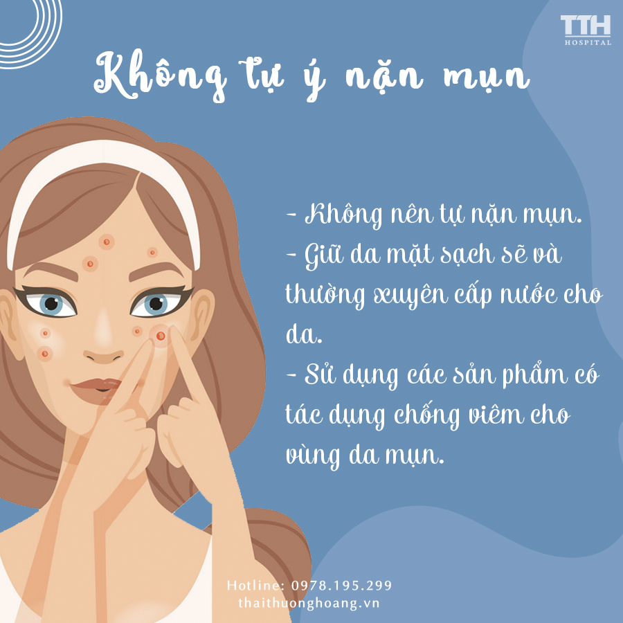 Không tự ý nặn mụn