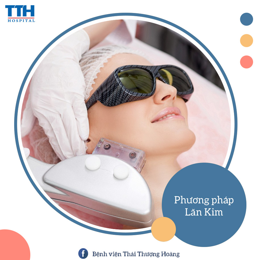 Điều trị sẹo bằng phương pháp Laser CO2 Fractional
