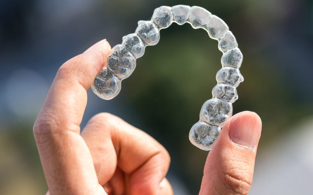 Tại sao niềng Invisalign lợi điểm hơn so với niềng mắc cài sau khi làm răng sứ?