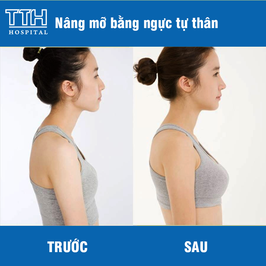 Kích thước vòng 1 tăng hơn, quyến rũ hơn