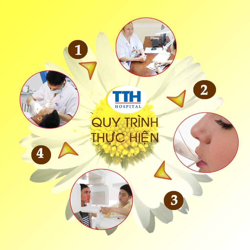 Quy trình cắt lợi trùm