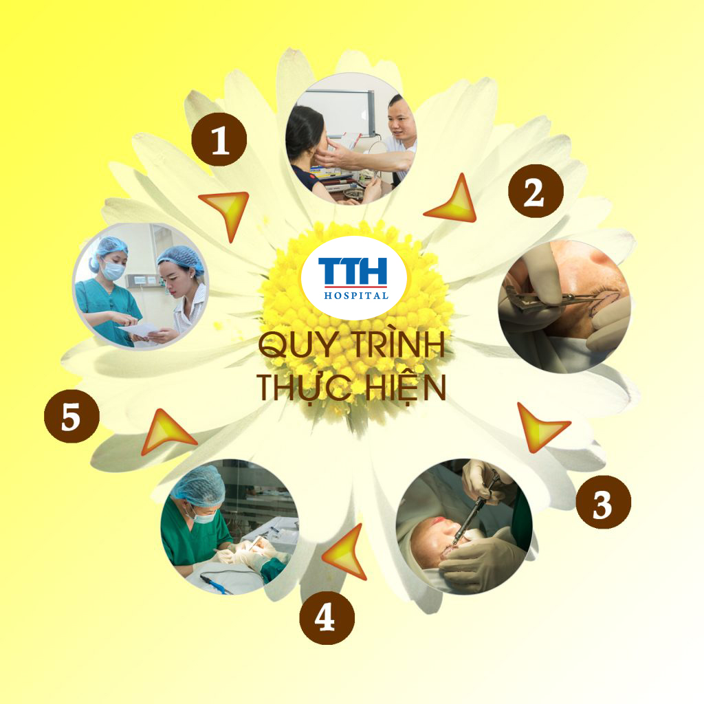 Toàn bộ quá trình được thực hiện từ 15-20 phút