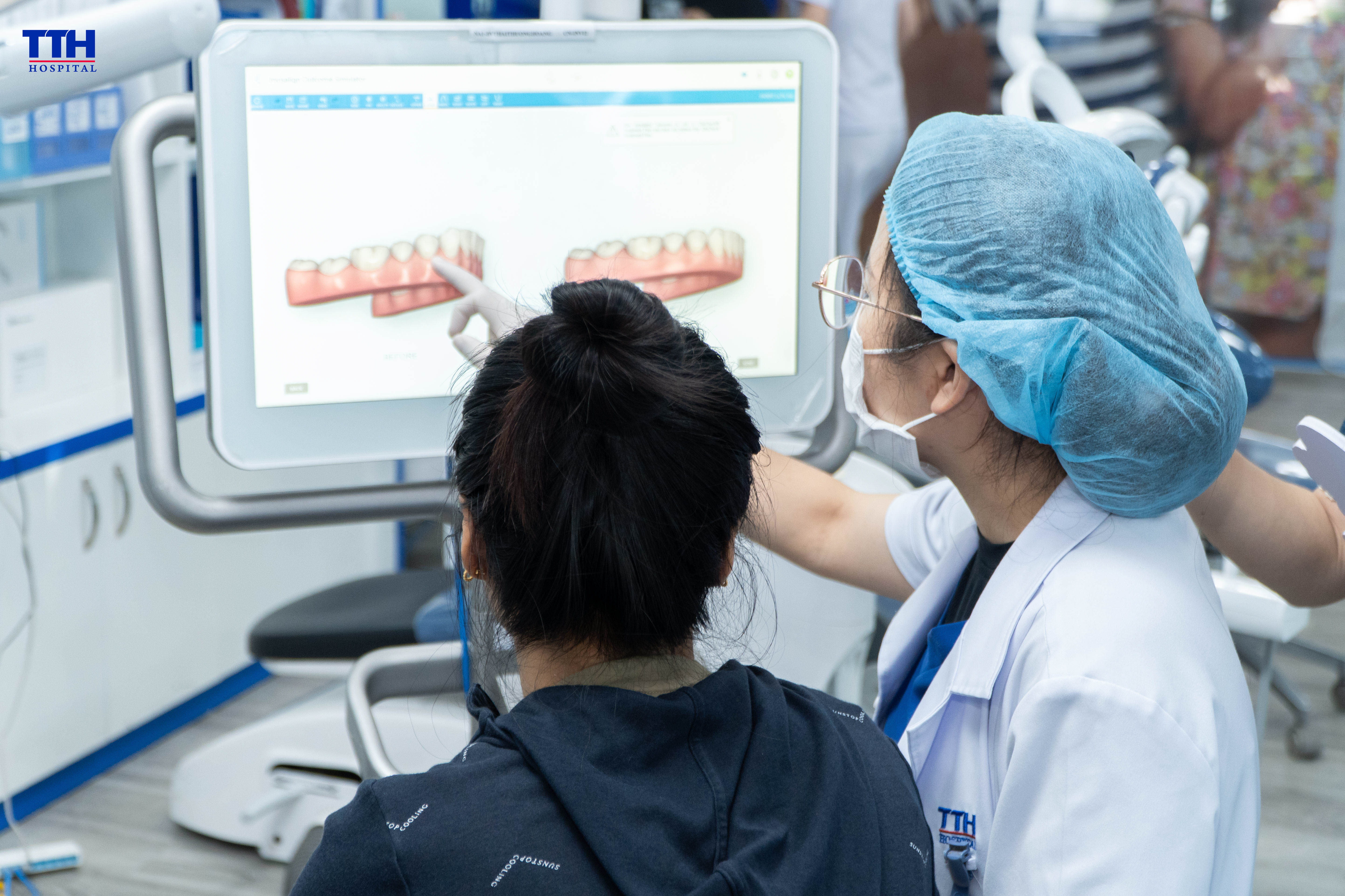 Những điều cần lưu ý khi niềng răng sứ với Invisalign