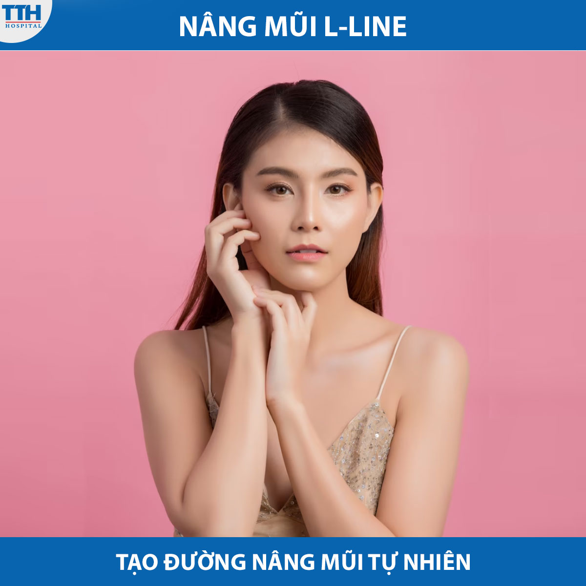 Nâng mũi L-Line tạo đường nâng mũi tự nhiên