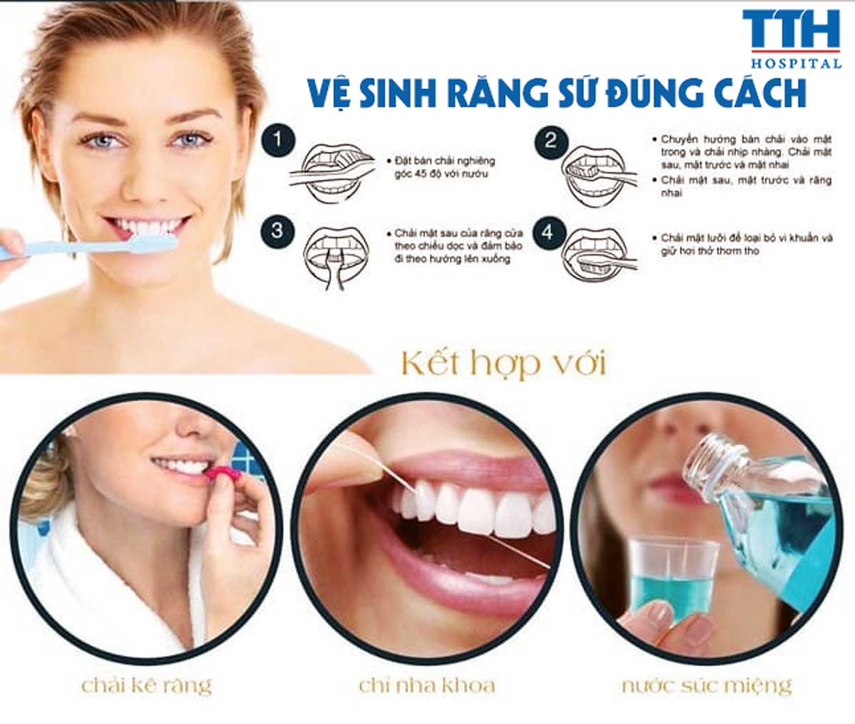 Cách vệ sinh răng sứ đúng cách