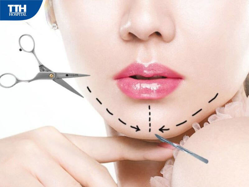 Ai phù hợp với tái cấu trúc gương mặt V-line?