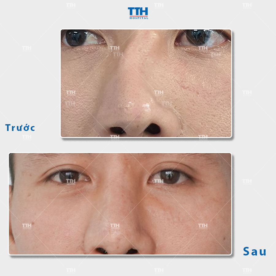 Nghỉ ngơi và hoạt động nhẹ nhàng