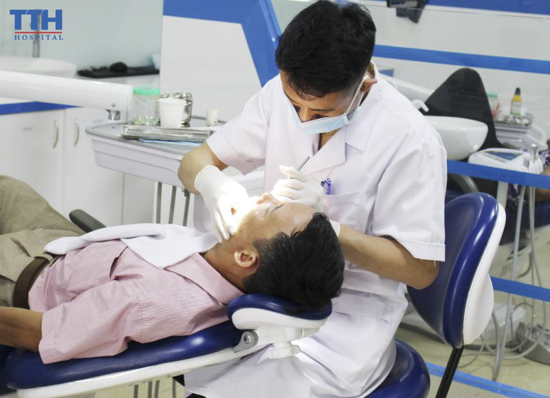 Lấy cao răng là gì?