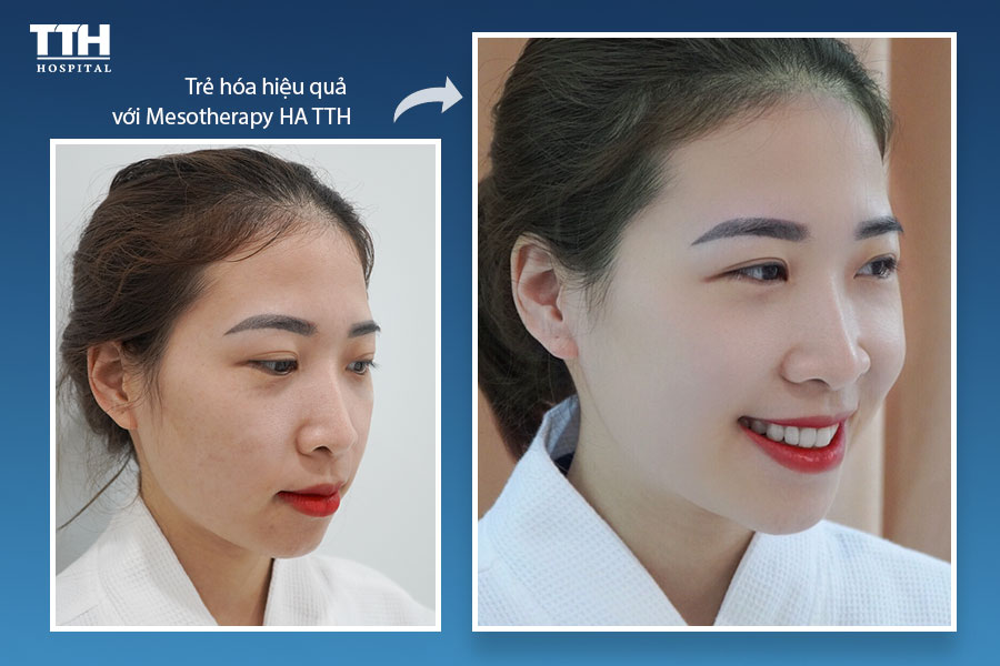 Công nghệ trẻ hóa làn da tại bệnh viện Thái Thượng Hoàng