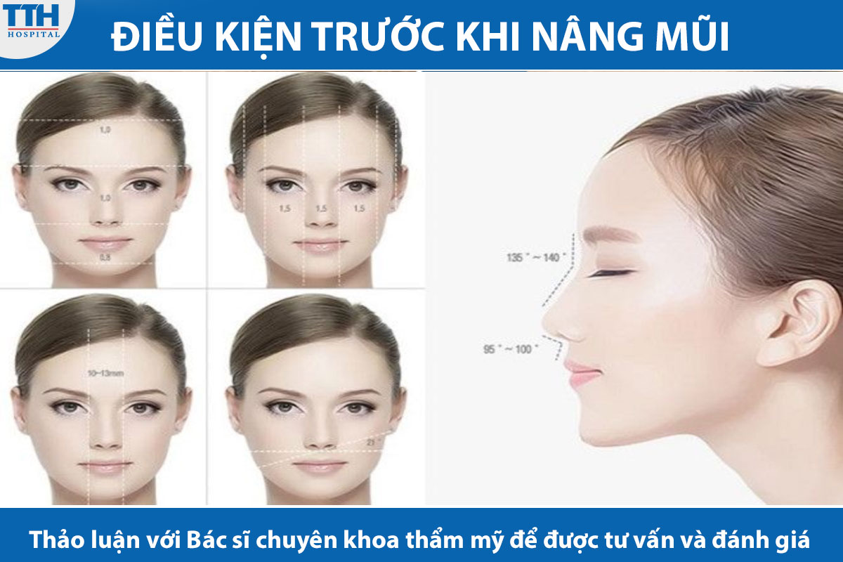 Điều kiện trước khi nâng mũi