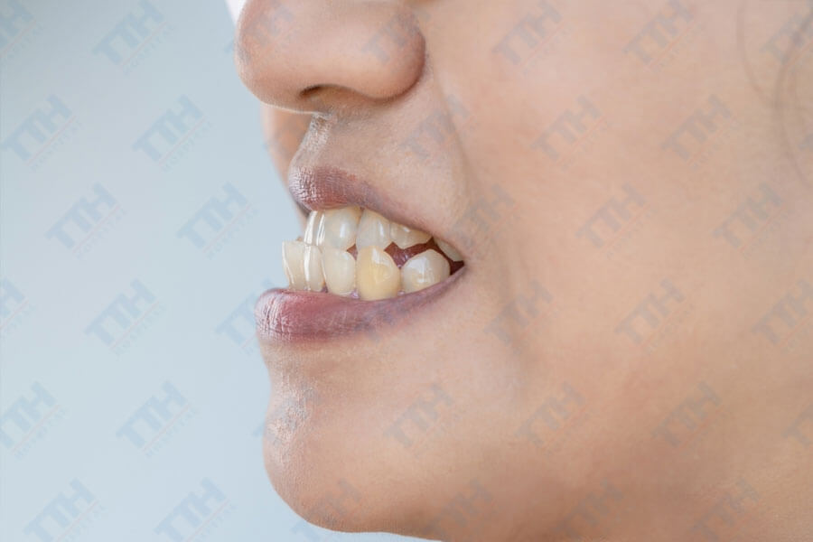 Đối tượng cần phẫu thuật hàm mặt