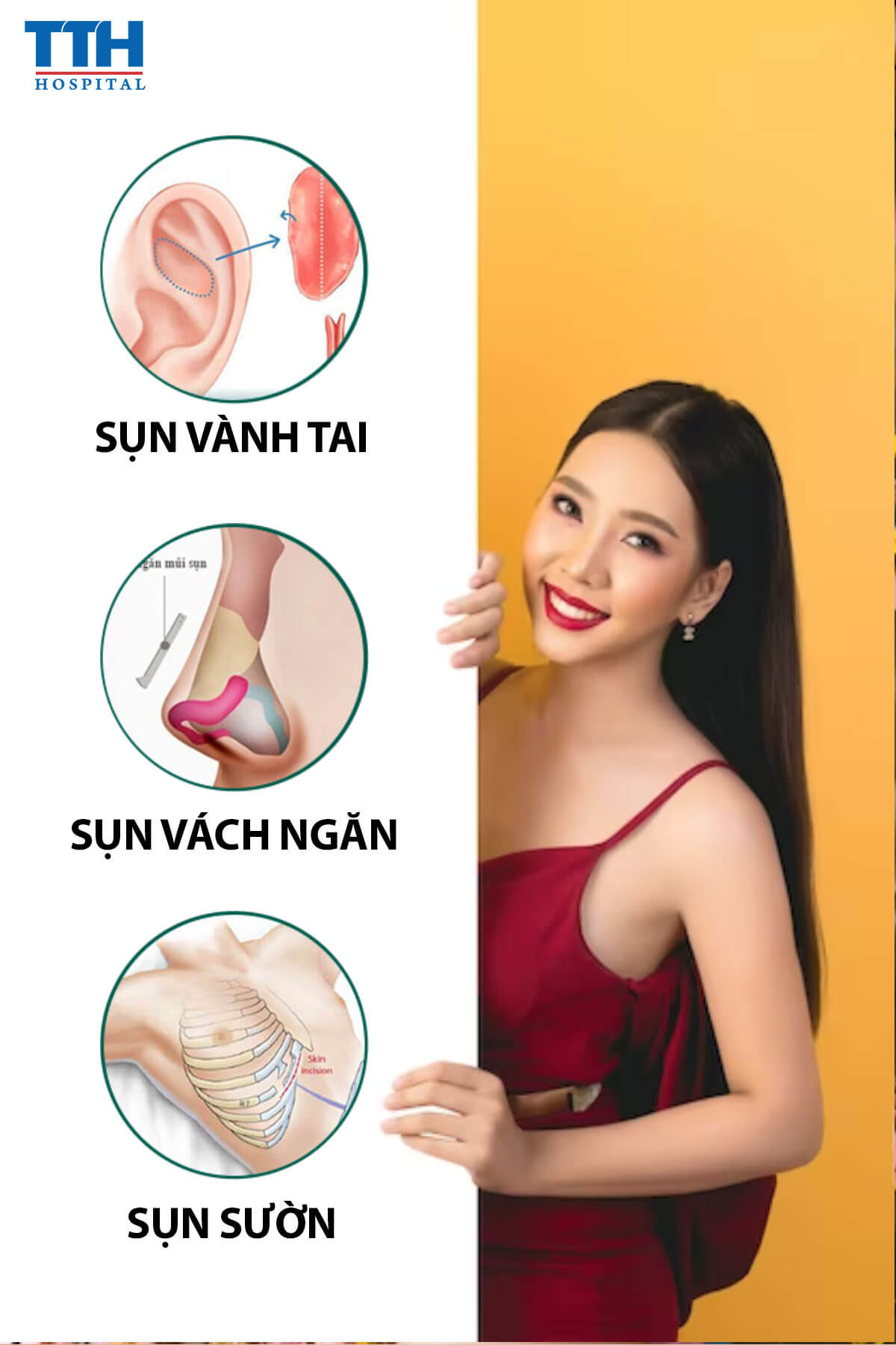 Loại Sụn Tự Thân Thường Sử Dụng Trong Nâng Mũi Sụn Tự Thân - Nâng mũi tại Vinh Nghệ An