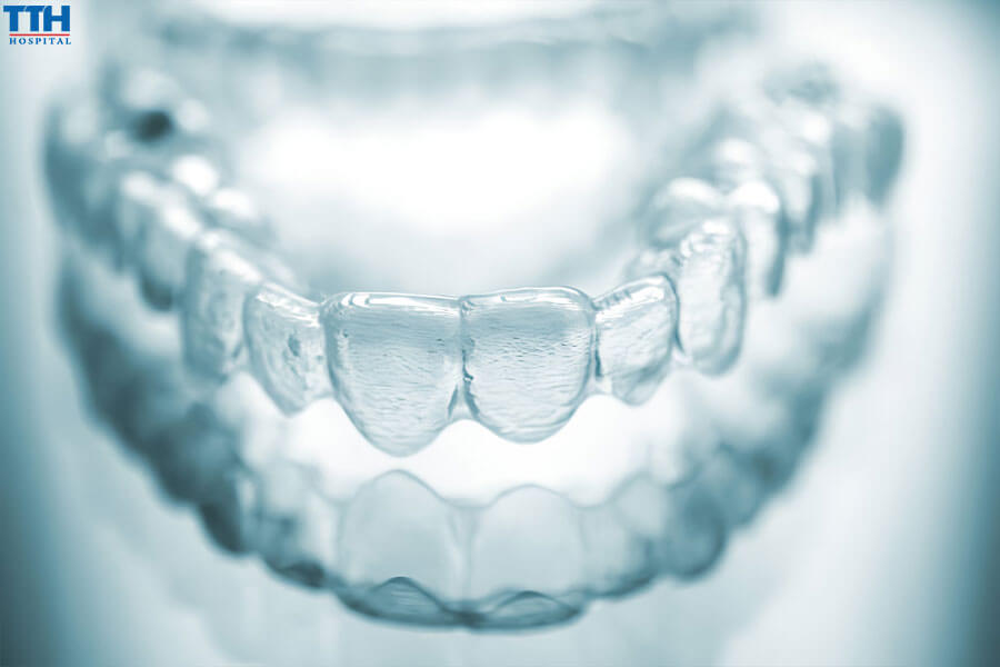 Lợi Ích Của Việc Sử Dụng Vật Liệu Cao Cấp Trong Niềng Răng Invisalign