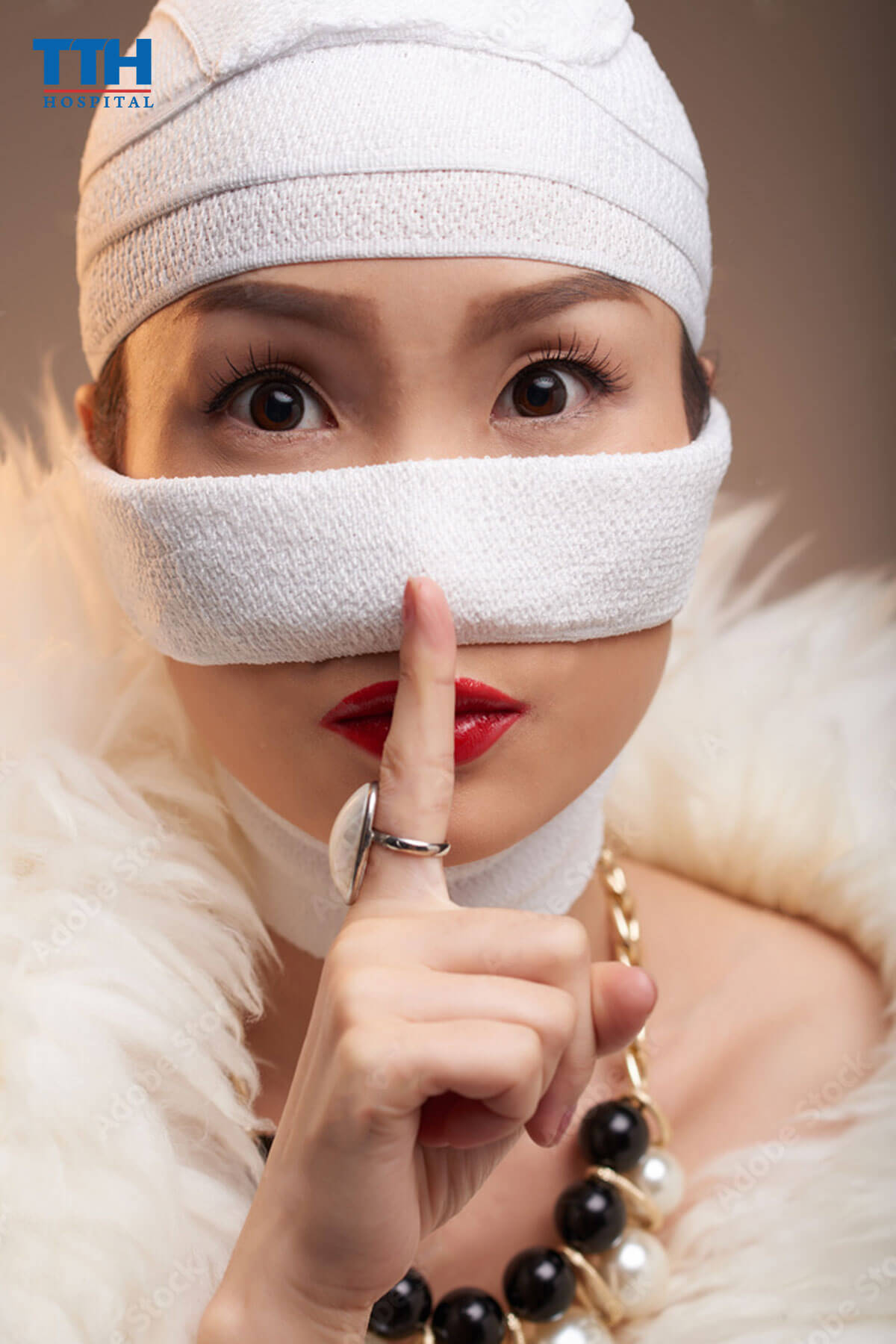 Lưu Ý Quan Trọng Về Thời gian Sụn Mũi Bám Chắc - nâng mũi tại vinh nghệ an