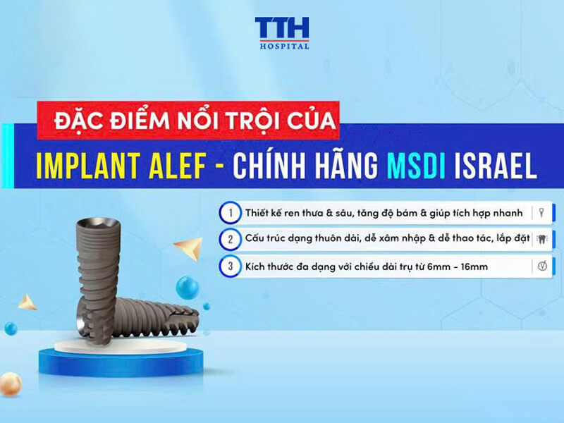 Những điểm nổi bật của trụ Alef