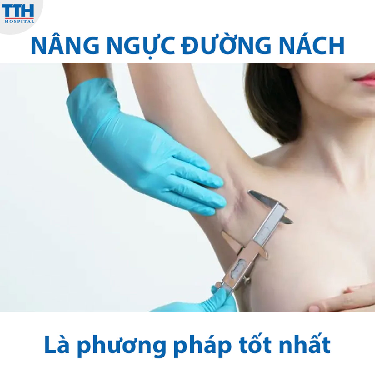 Nâng ngực đường nách là phương pháp được đánh giá là tốt nhất hiện nay