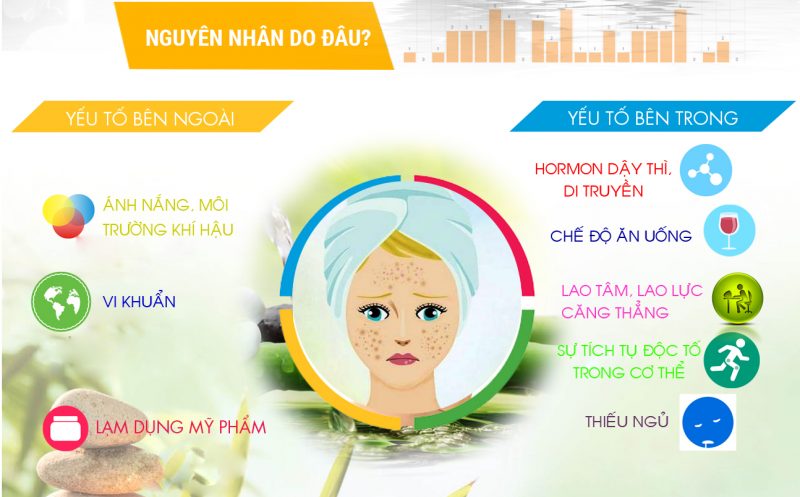 Nguyên nhân gây mụn