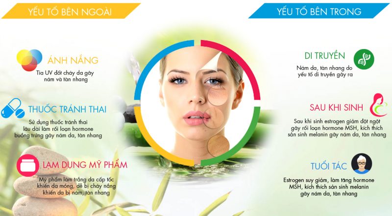 Những ai thường dễ gặp phải tình trạng nám, tàn nhang?
