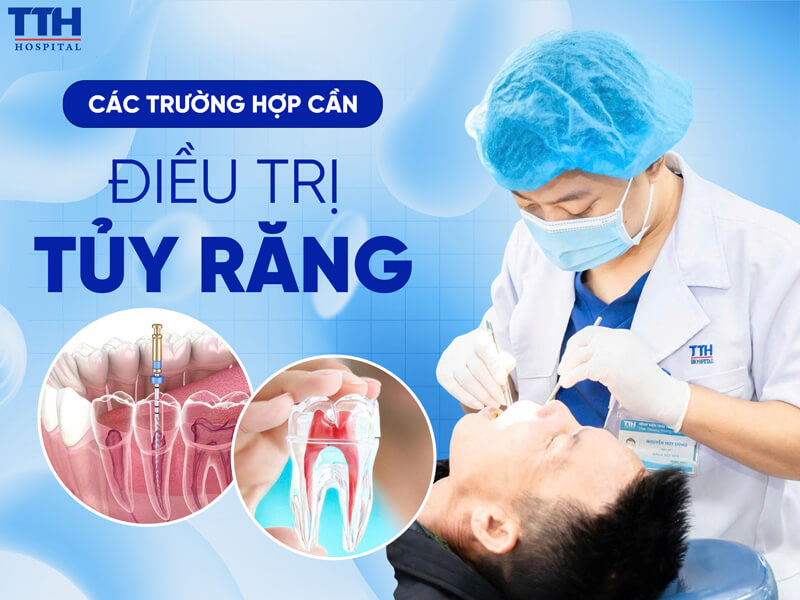 Những dấu hiệu cảnh báo viêm tủy răng không nên bỏ qua
