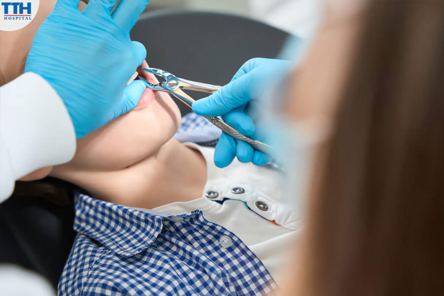 Niềng Răng Invisalign Có Cần Nhổ Răng Không?
