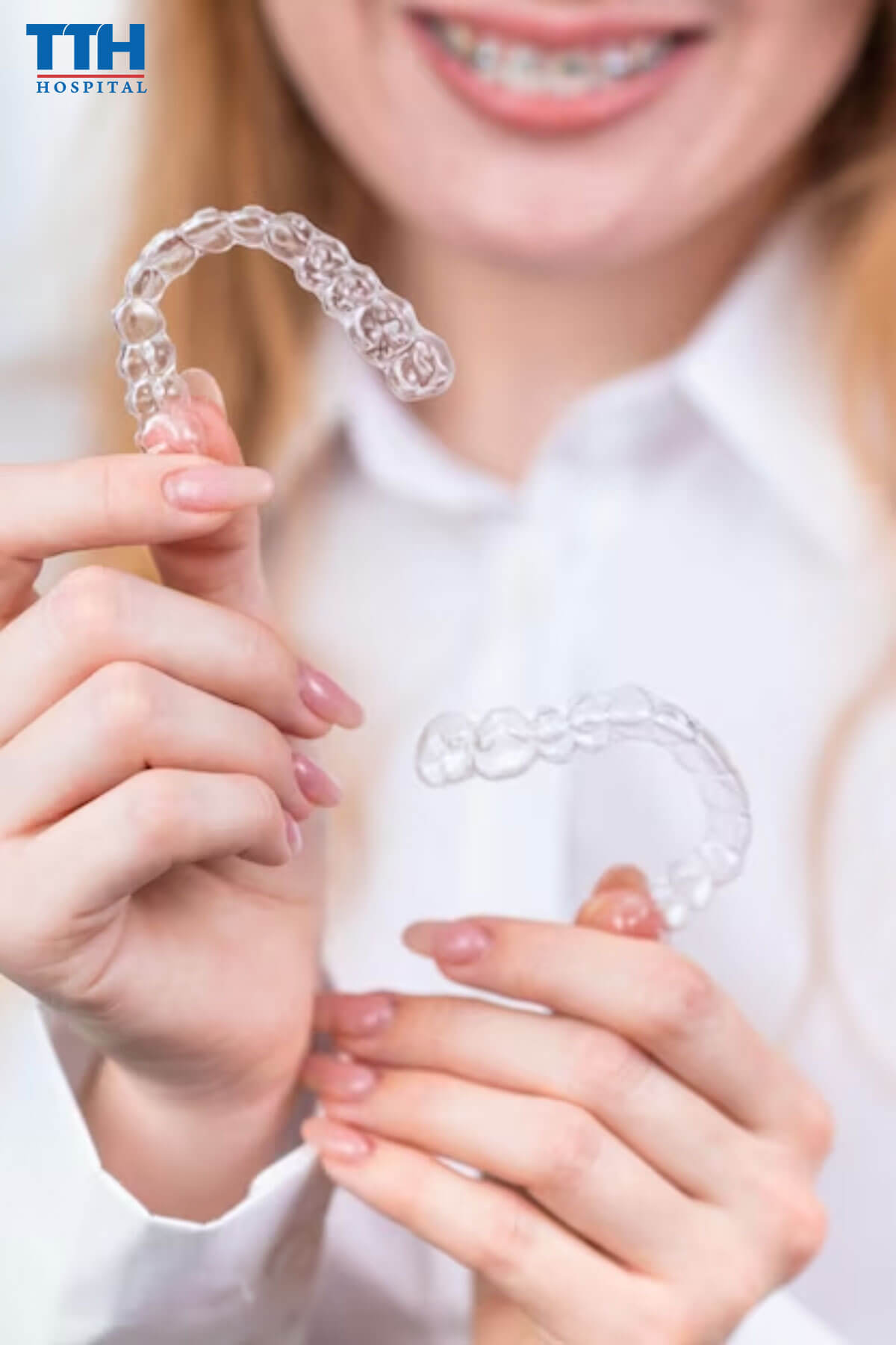 Niềng răng trong suốt Invisalign tại Vinh Nghệ An là gì?