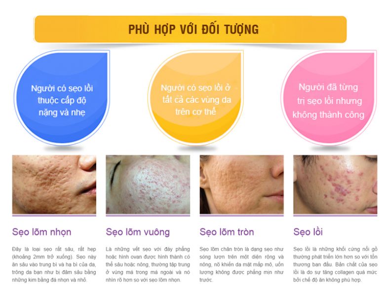 Đối tượng sử dụng phương pháp trị sẹo công nghệ CO2 FRACTIONAL LASER