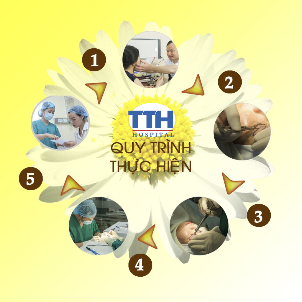 Quy trình phẫu thuật cắt mí mắt sửa lại được thực hiện theo quy trình phẫu thuật chuẩn của Bộ Y tế