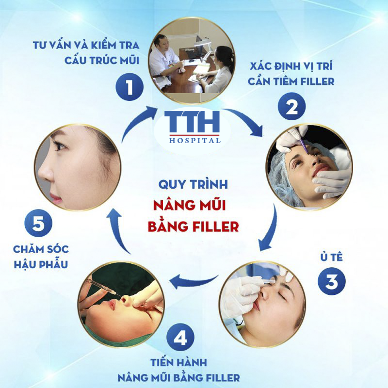 Quy trình thực hiện Nâng mũi không phẫu thuật