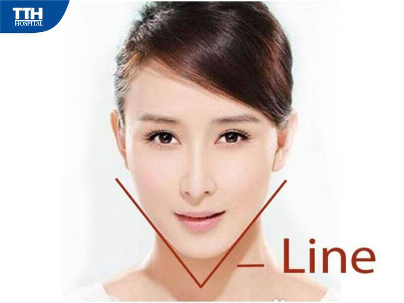 Tái cấu trúc gương mặt V-line là gì?
