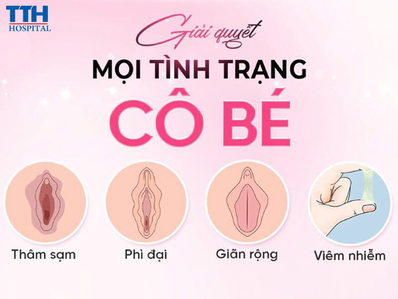 Tân trang vùng kín là gì?