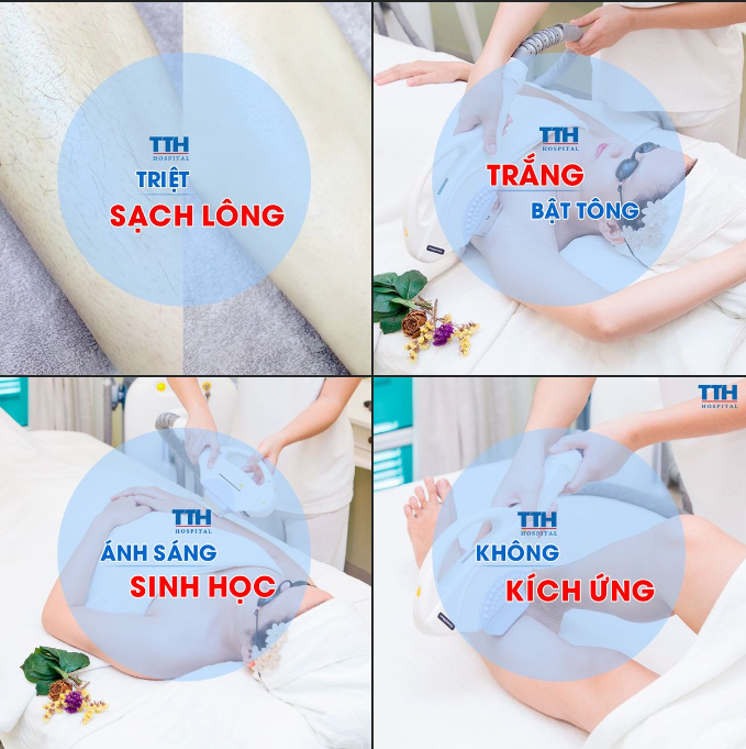 Triệt lông an toàn tại bệnh viện Thái Thượng Hoàng