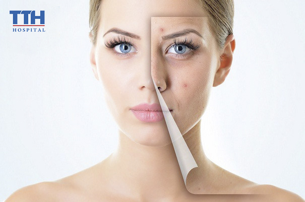 Điều trị sẹo