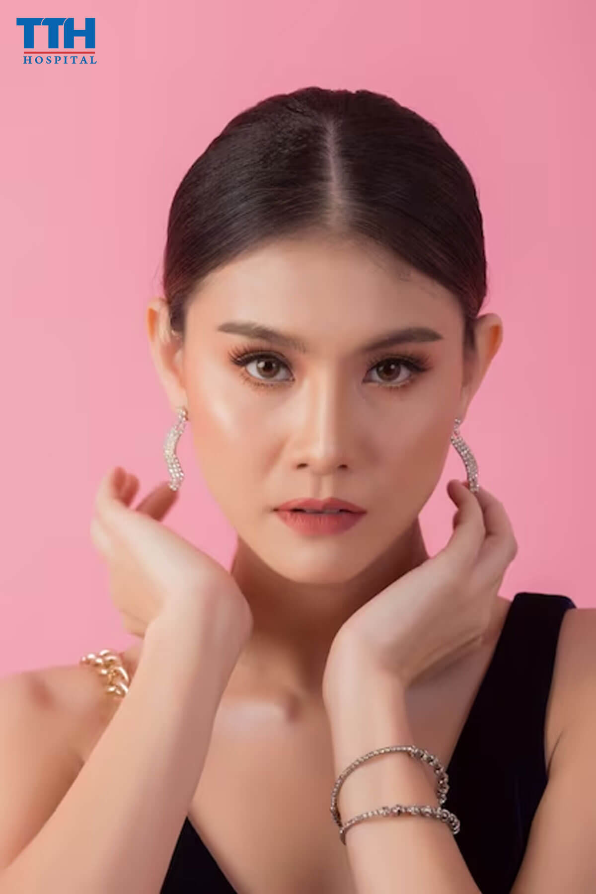 Ưu Điểm Của Nâng Mũi Chỉ Hiko - nâng mũi tại Vinh