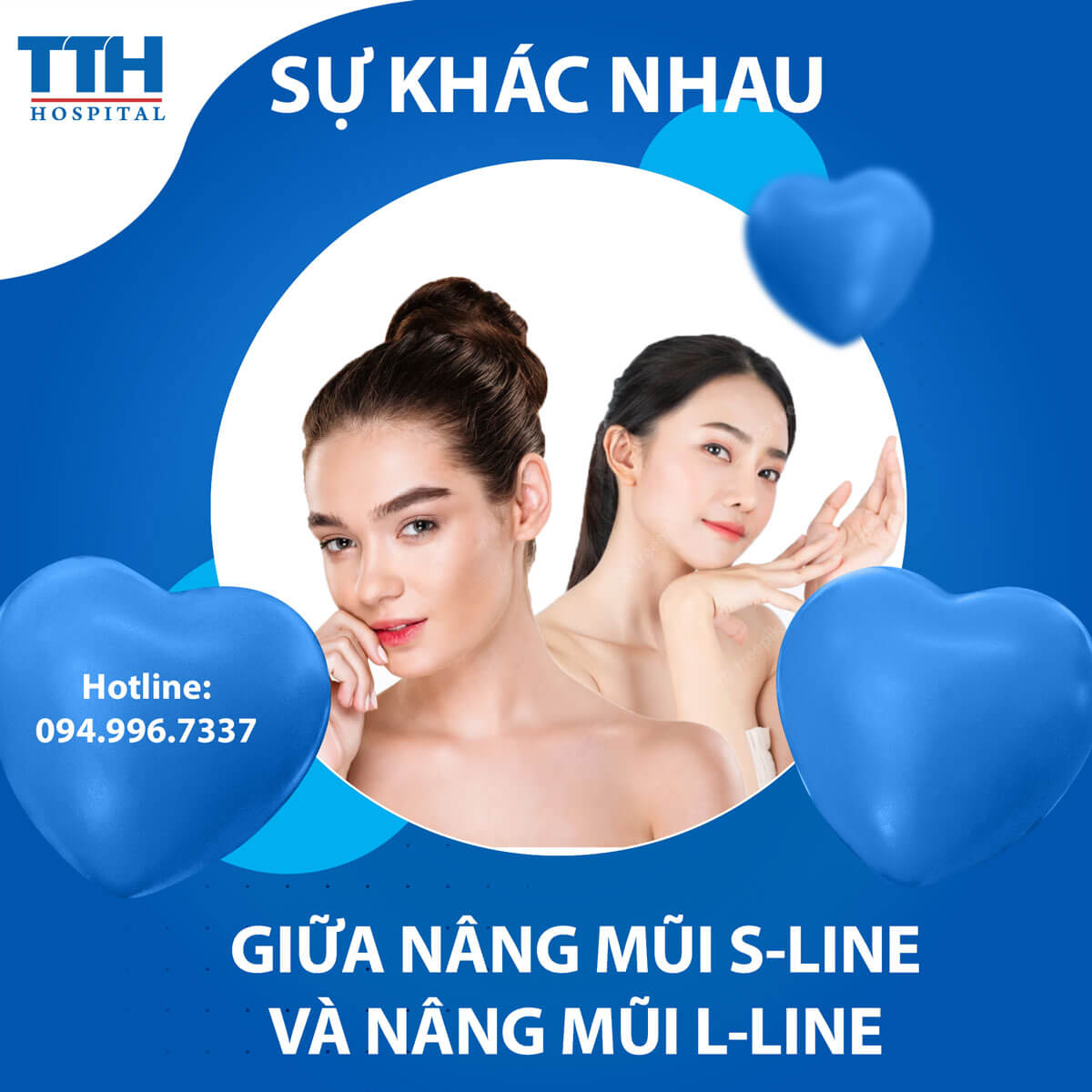Sự khác nhau giữa nâng mũi S-line và nâng mũi L-line