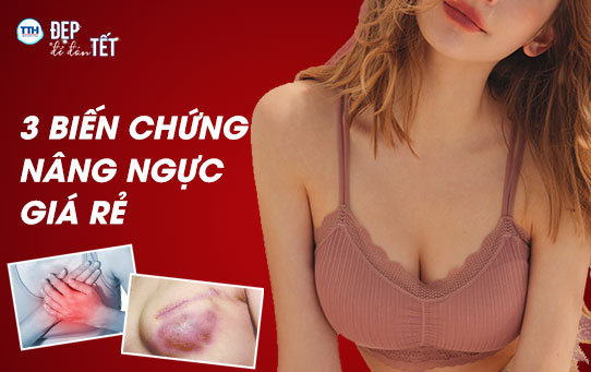 3 Biến chứng có thể xảy ra khi nâng ngực giá rẻ tại Nghệ An
