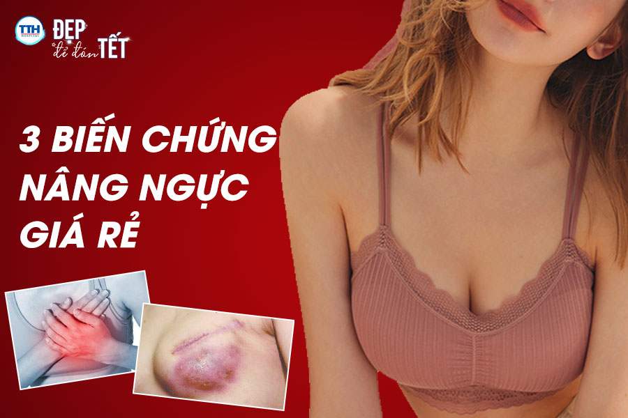 3 Biến chứng có thể xảy ra khi nâng ngực giá rẻ tại Nghệ An