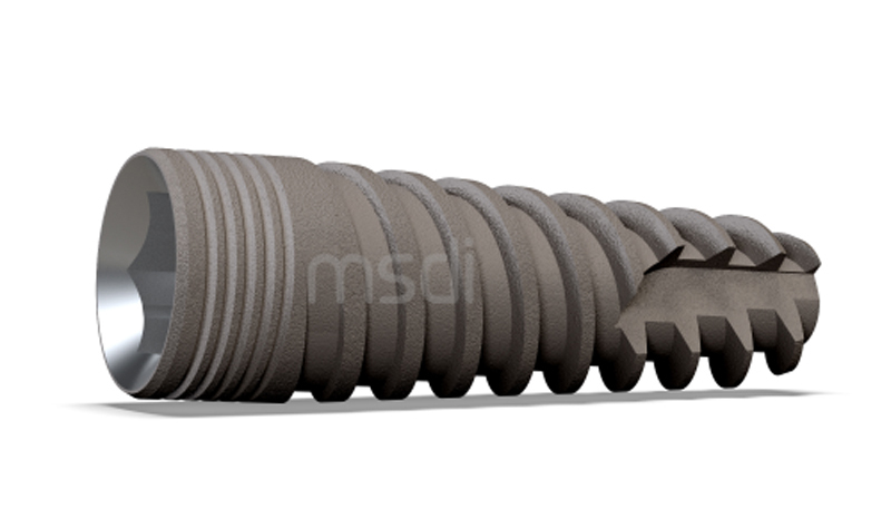 Trụ Implant Alef có tốt không? Tìm Hiểu Các Thông Tin Về Trụ Implant Alef