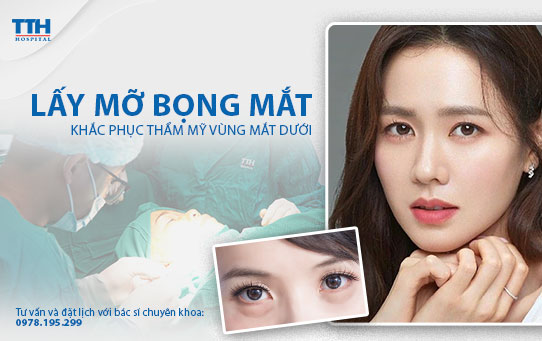Lấy bọng mắt, khắc phục nếp nhăn vùng mắt dưới hiệu quả. Bệnh viện Thái Thượng Hoàng - Địa chỉ cắt mí mắt dưới uy tín Nghệ An, Hà Tĩnh