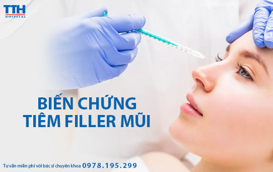 Biến chứng tiêm filler mũi. Địa chỉ tiêm filler uy tín Nghệ An, Hà Tĩnh