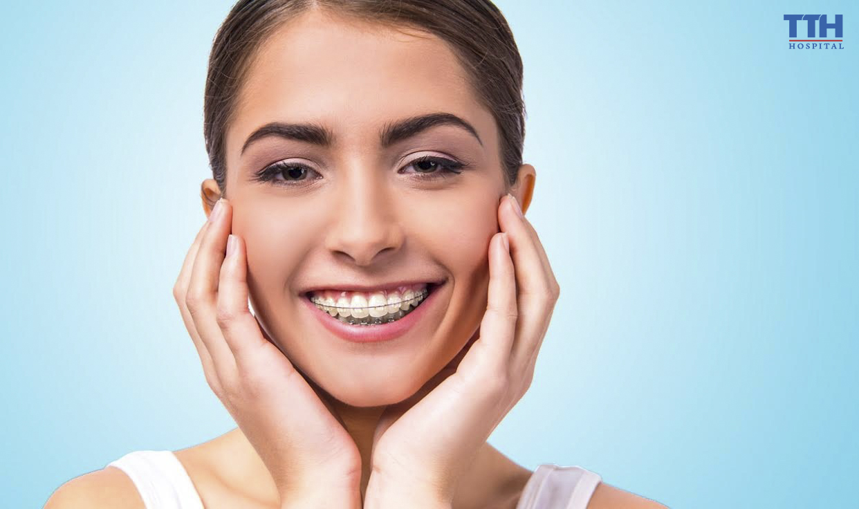 CÁC VẤN ĐỀ THƯỜNG GẶP KHI NIỀNG RĂNG VÀ GIẢI PHÁP