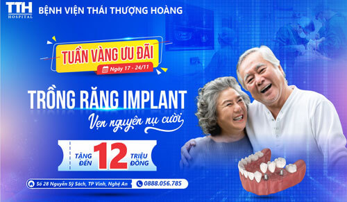 Tuần vàng ưu đãi trồng răng Implant