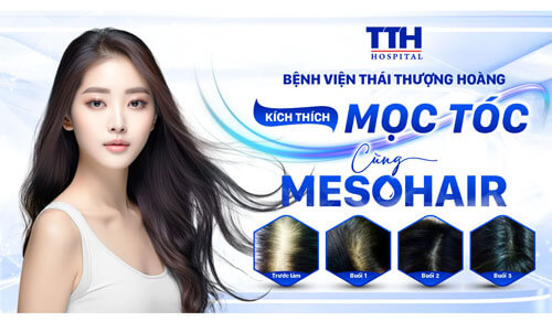 Hướng Dẫn Chăm Sóc Sau Khi Điều Trị Meso Hair