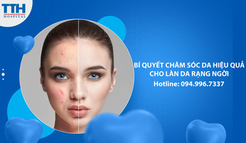 Bí quyết chăm sóc da hiệu quả cho làn da rạng ngời