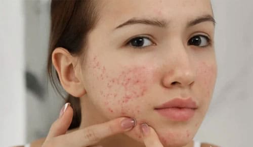 BẬT MÍ 5 BƯỚC CHĂM SÓC DA SAU TẾT ĐƠN GIẢN MÀ HIỆU QUẢ!