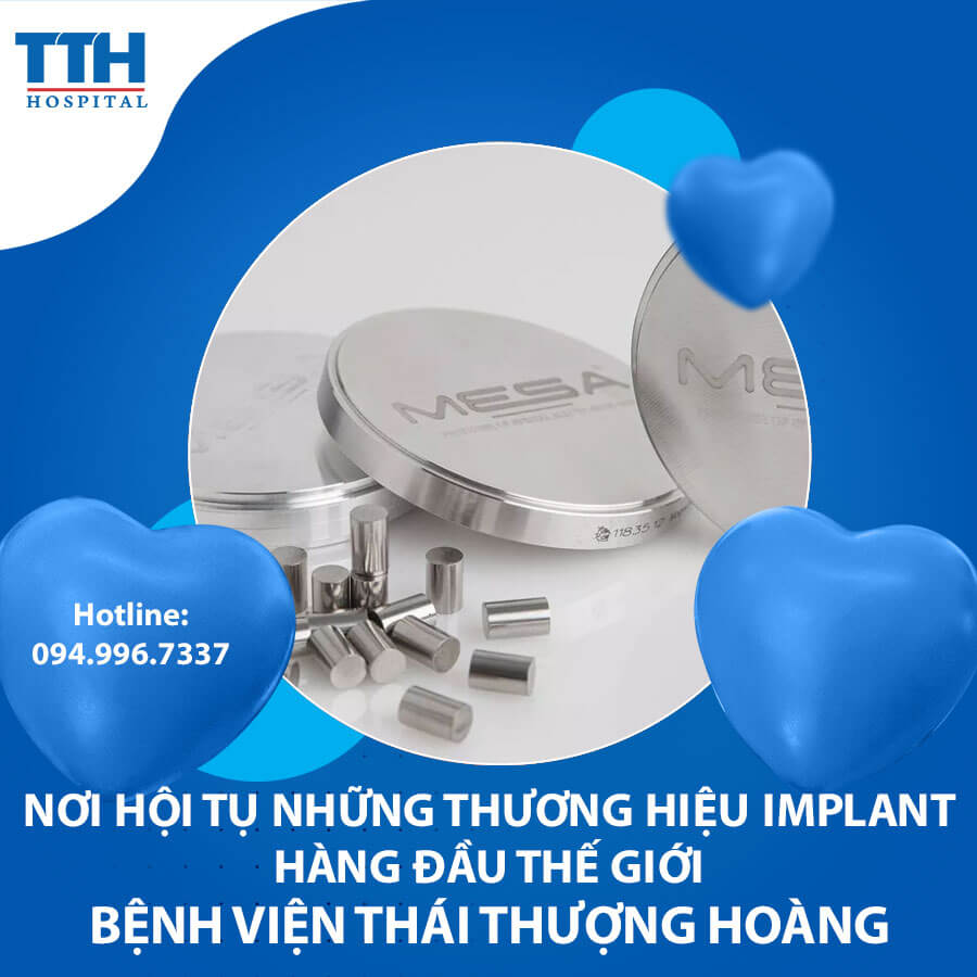 Bệnh viện Thái Thượng Hoàng - nơi hội tụ những thương hiệu Implant hàng đầu thế giới