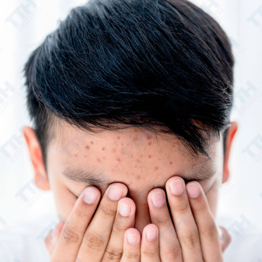 Cách chăm sóc da mặt cho nam giới tuổi dậy thì