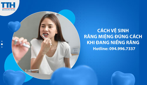 Cách Vệ Sinh Răng Miệng Đúng Cách Khi Đang Niềng Răng