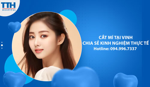 Cắt Mí Tại Vinh - Chia Sẻ Kinh Nghiệm Thực Tế