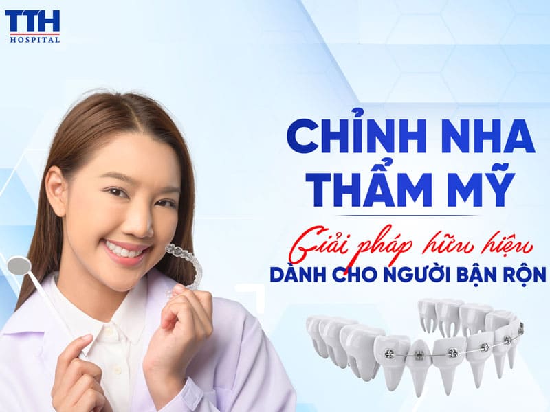 Chỉnh nha thẩm mỹ - Giải pháp hữu hiệu dành cho người bận rộn