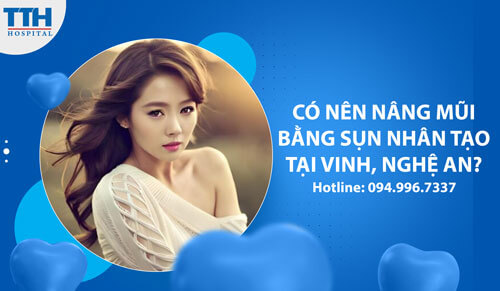 Có Nên Nâng Mũi Bằng Sụn Nhân Tạo tại Vinh, Nghệ An?